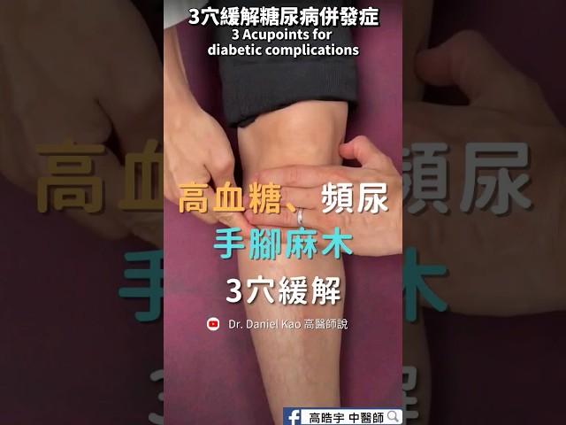 高血糖、頻尿、手腳麻木 3穴道緩解 3 Acupoints to Relieve Frequent Urination to High Blood Sugar