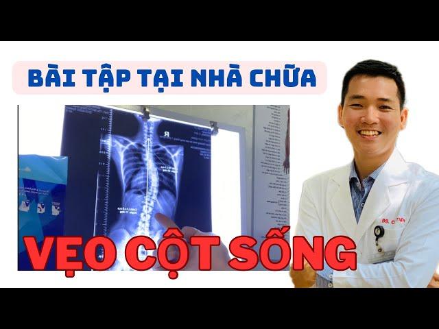 Bài Tập Chữa Vẹo Cột Sống Ngay Tại Nhà| Bác Sĩ Tiến