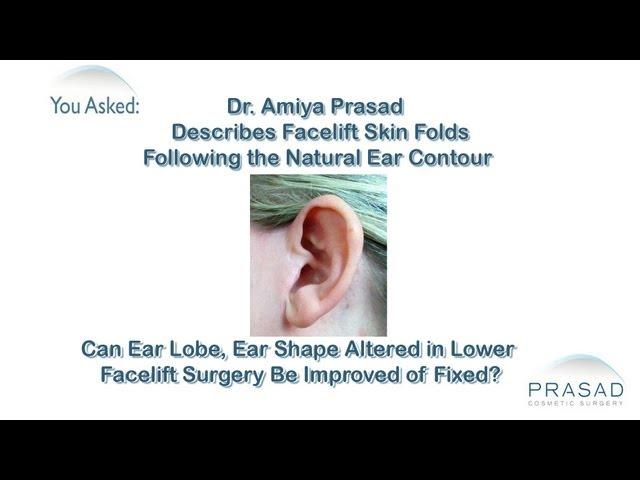 How to Follow the Natural Ear Contour in Facelift Healing