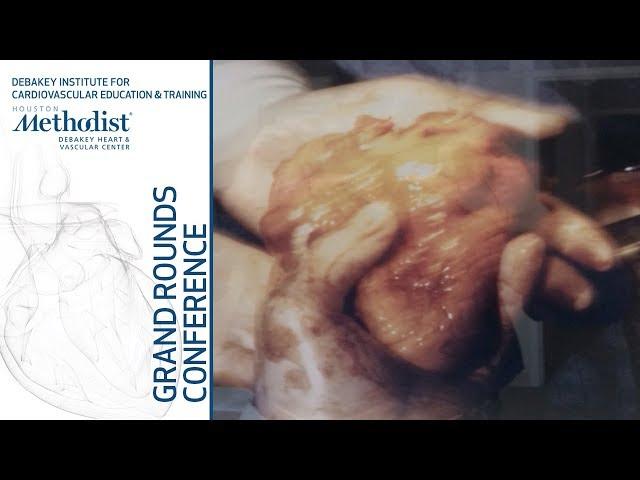 Two Decades of Thoracic Endovascular Aortic Repair (Himanshu J. Patel, MD) September 13, 2018