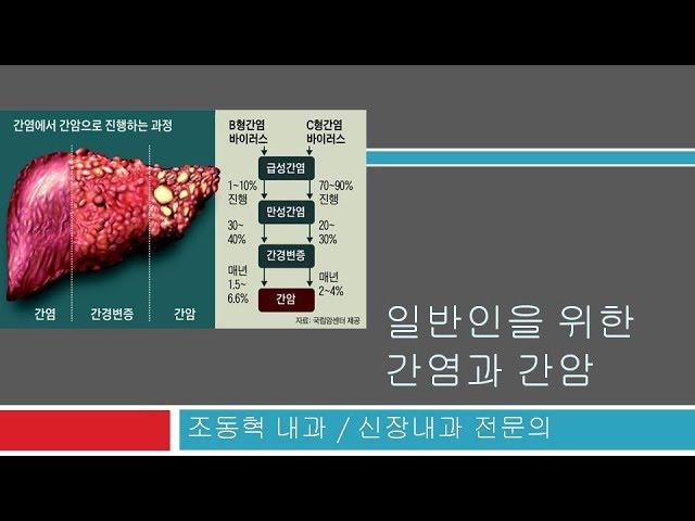 간염/간경화/간암 강의 (1편): 죽음과 건강에 대한 통계