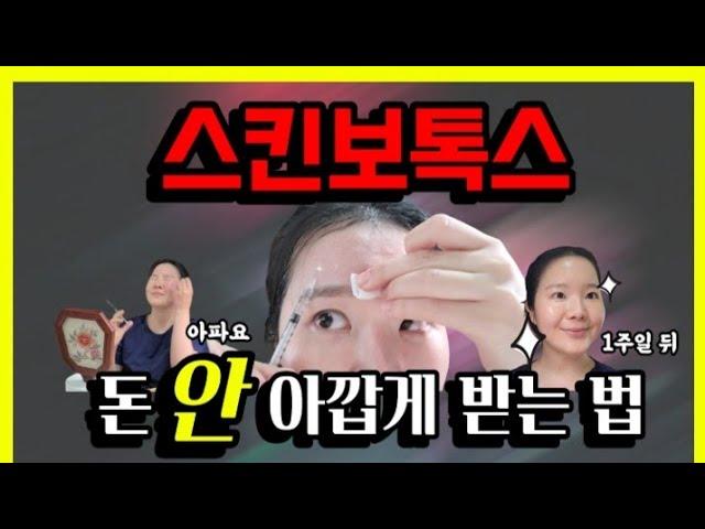 스킨보톡스 총정리! 셀프시술부터 리얼후기까지 생생히 알려드려요