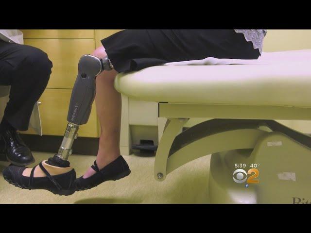 New Surgery Relieves Nerve Pain For Amputees