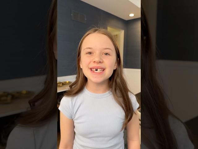 Why You Never Pull A Tooth Out