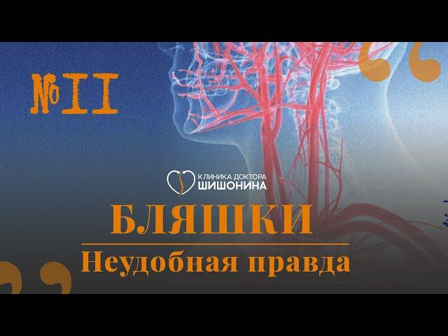 Бляшки и как с ними жить: рассказывает сосудистый хирург в новом выпуске «Хорошей медицины» 