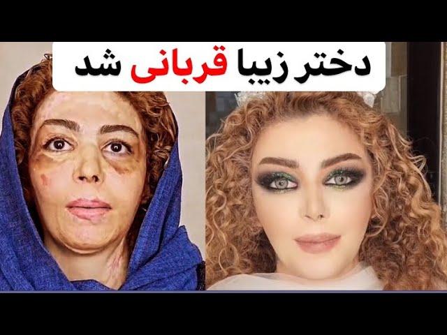 بادکنک تولد باعث انفجار شد | میکاپ سوختگی | کاترین آریازند#makeup