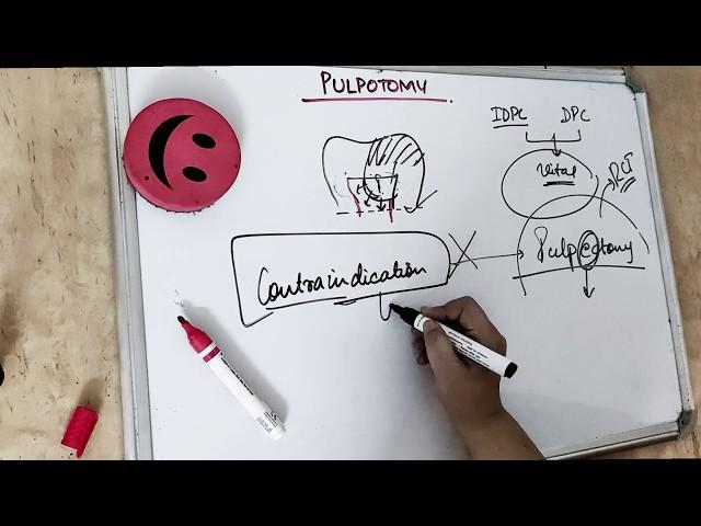 pulpotomy lecture (McDonald - Textbook)