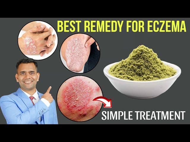 Best Natural Treatment For Eczema | How To Get Rid Of Eczema Naturally - Dr. Vivek Joshi