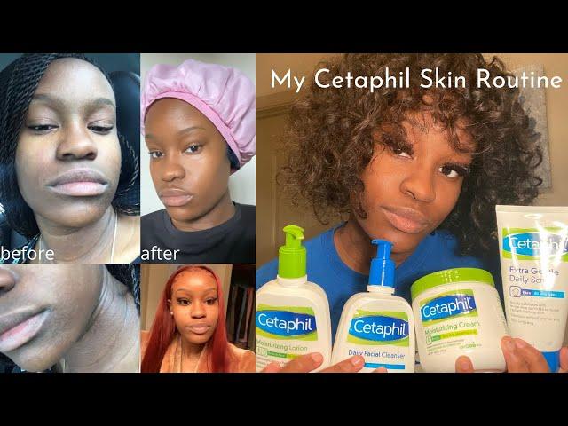 CETAPHIL SKINCARE ROUTINE (day + night) | how to treat acne & excema