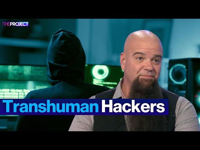 The Transhuman Hackers Who Are Getting Chips Implanted