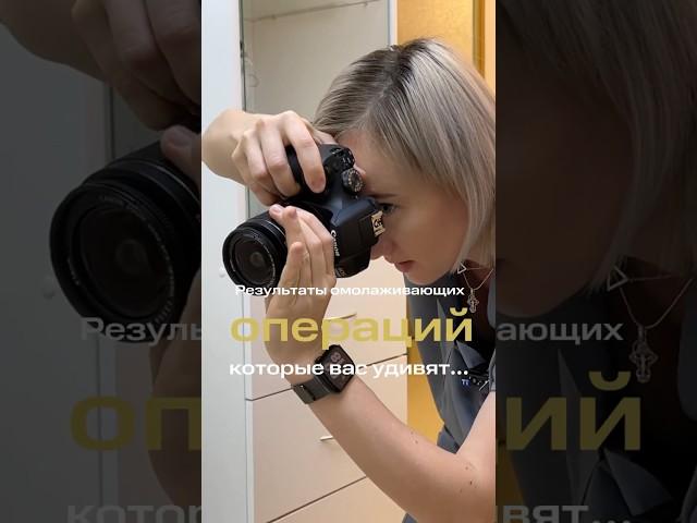 Результаты омолаживающих и бьютифицируюших операций от пластического хирурга Ю.Р. Юнусовой