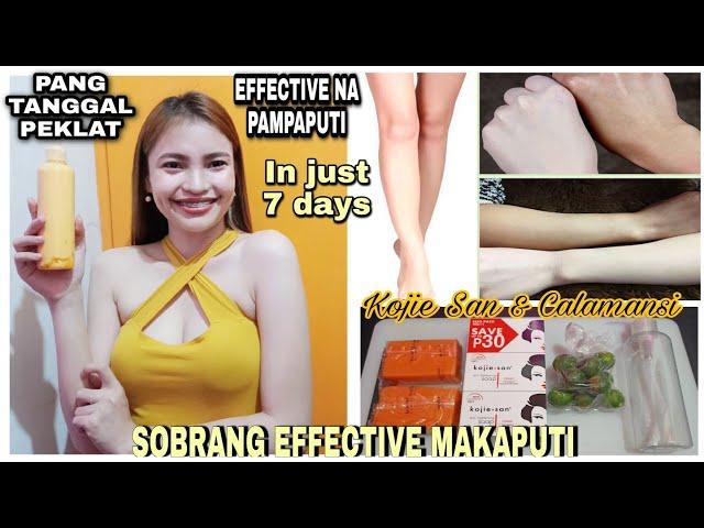 EFFECTIVE NA PAMPAPUTI IN JUST 7 DAYS | PAANO IAPPLY ANG KOJIC SOAP AT CALAMANSI STEP BY STEP