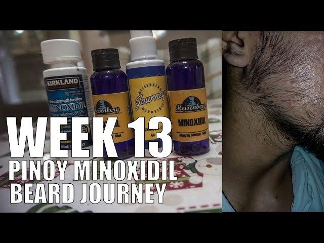 Week 13 Pinoy Minoxidil Beard Journey - Kirkland Minoxidil 5%
