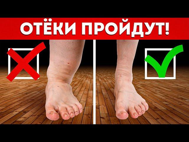 НОГИ больше не будут ОТЕКАТЬ! / ЭФФЕКТИВНОЕ лечение отеков ног