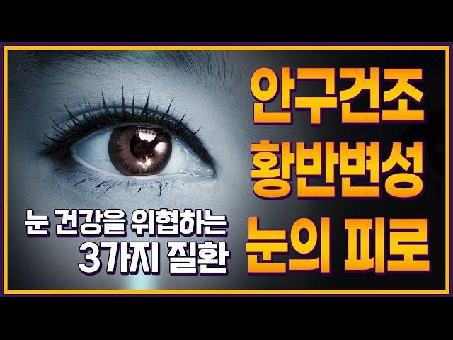 혹사당하는 눈을 지키는 3가지 방법!!_눈건강,안구건조,황반변성,눈의피로,바람에 눈물,블루라이트,눈의노화,노안,건조한눈