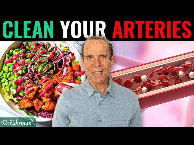 Can a Nutritarian Diet Remove Calcified Plaque in Arteries? | Dr. Joel Fuhrman