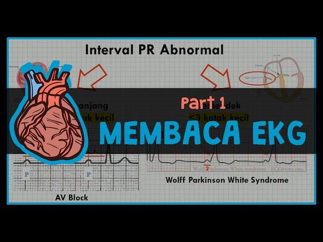 (1/2) Cara Membaca EKG (LENGKAP & MUDAH DIPAHAMI): #2 ELEKTROKARDIOGRAM