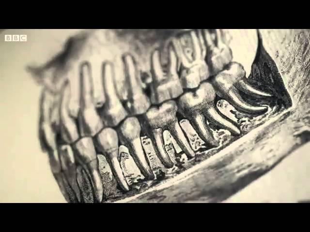 BBC Drills - Dentures and Dentistry An Oral History