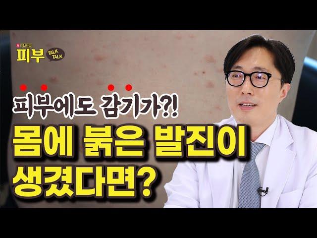 다른 피부염과 헷갈리기 쉬운 ‘장미색 비강진’ 구별법! - 박치영의 피부 톡톡 #151