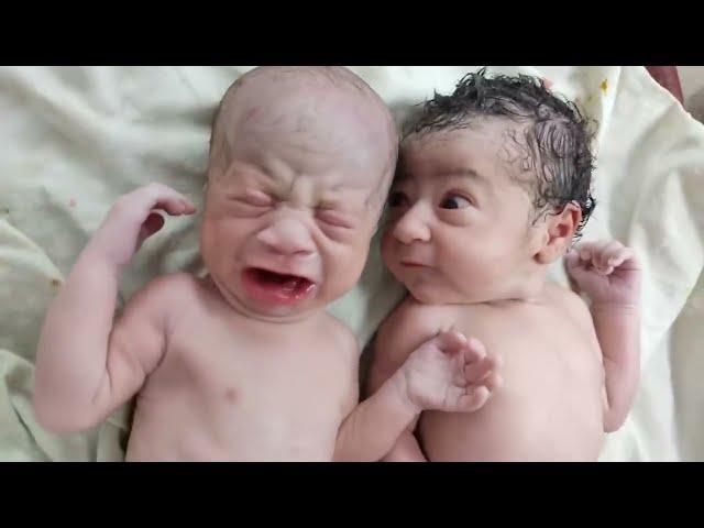Twins after birth where one is fed up with other one cry || Just Stop It 