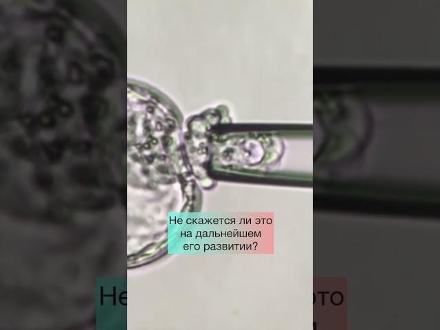 Безопасна ли биопсия эмбрионов