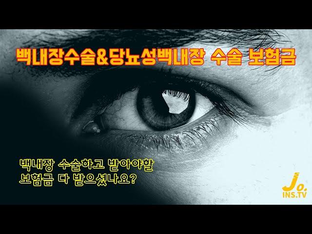 백내장수술과 수술보험금