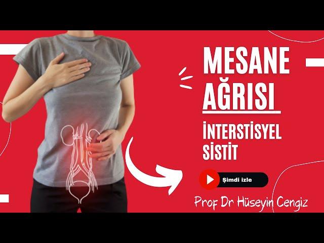 AĞRILI MESANE  SENDROMU - İNTERSTİSYEL SİSTİT   (mesane ağrısı) (Prof Dr Hüseyin CENGİZ)