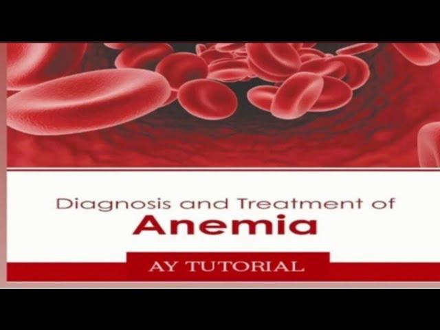 Iron Deficiency Anemia | # Anemia # HAP