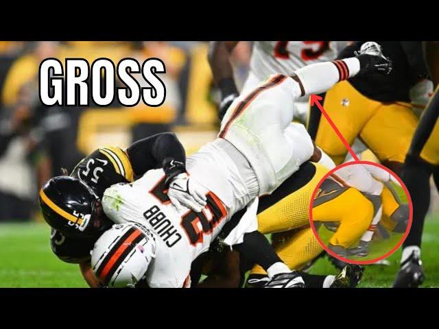 NFL "GROSSEST" INJURIES 