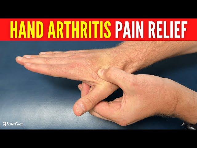 How to Relieve Hand Arthritis Pain in 30 SECONDS