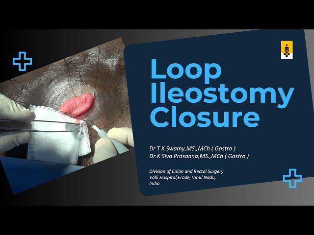 Loop Ileostomy Closure – Learn It Right, Close It Tight | Dr. T. K. Swamy