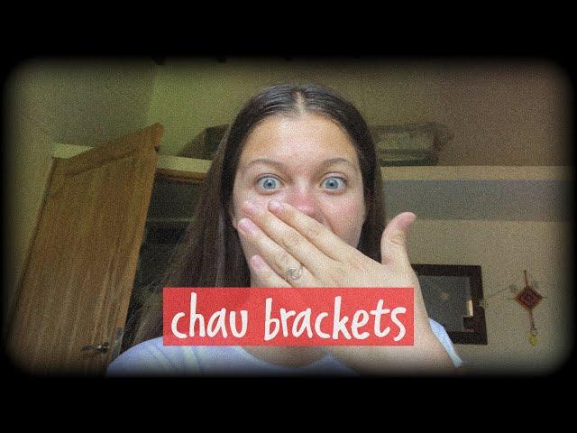 Un día conmigo: me sacan los brackets | chofico