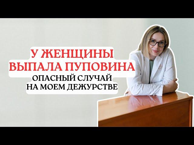 У женщины выпали петли пуповины | Мое дежурство в роддоме
