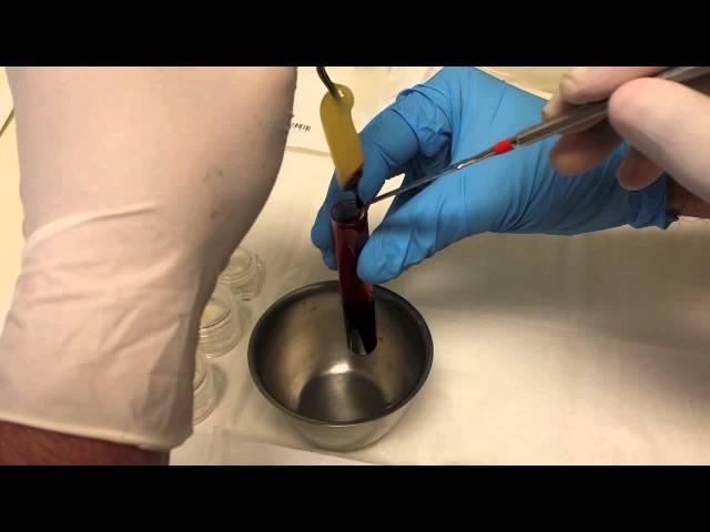 Platelet Rich Fibrin (PRF) - A short introductory Video