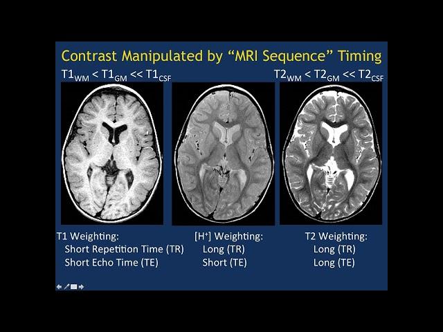 MRI Basics Part 1