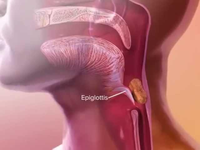 Learn@Visible Body - How the Epiglottis Works