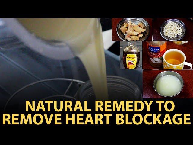 Natural Remedy to Remove Heart Blockage | Home-made Remedy for Blocked Arteries