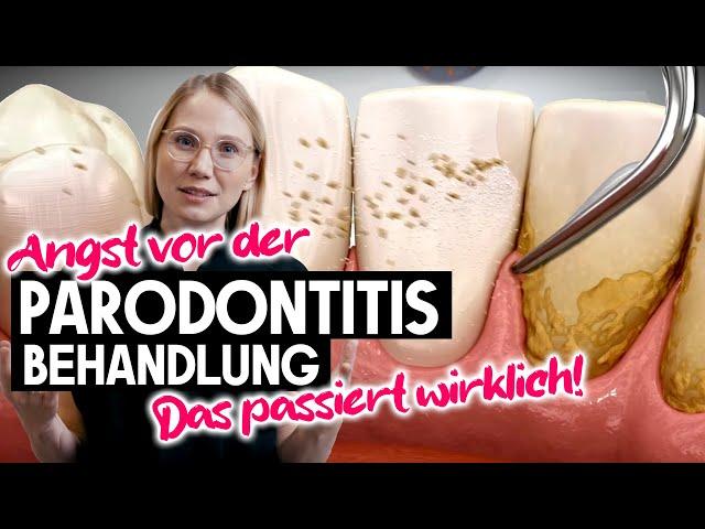 Behandlung unter dem Zahnflleisch! 50% der Bevölkerung werden diese Erfahrung machen | Parodontitis