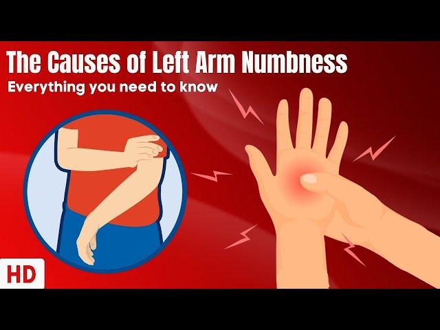 The Causes Of Left Arm Numbness