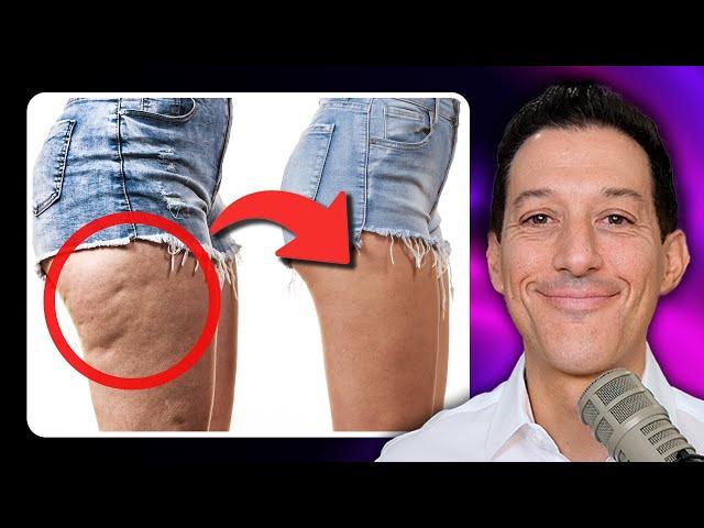 How Cellulite Is Created (and Reversed)