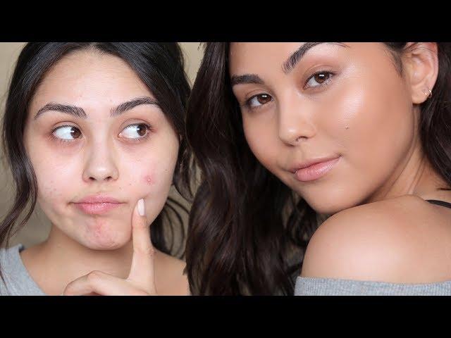 NO MAKEUP MAKEUP LOOK TO COVER ACNE | Roxette Arisa