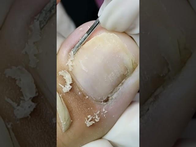 satisfying nail care