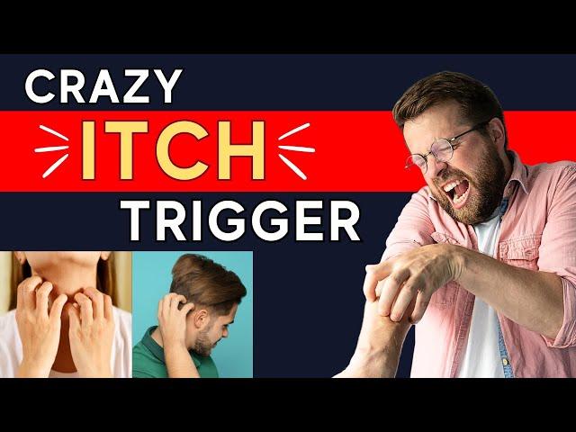 Got Itchy Skin Without Rash? (The SHOCKING Neuropathic Itch Trigger Explained) | Dr. Shawn Kwatra