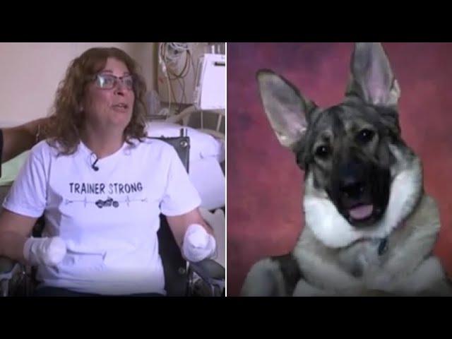 Woman Loses Arms And Legs Over A Dog Lick