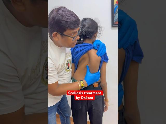 Scoliosis treatment #drrajneeshkant #worldfamouschiropractor