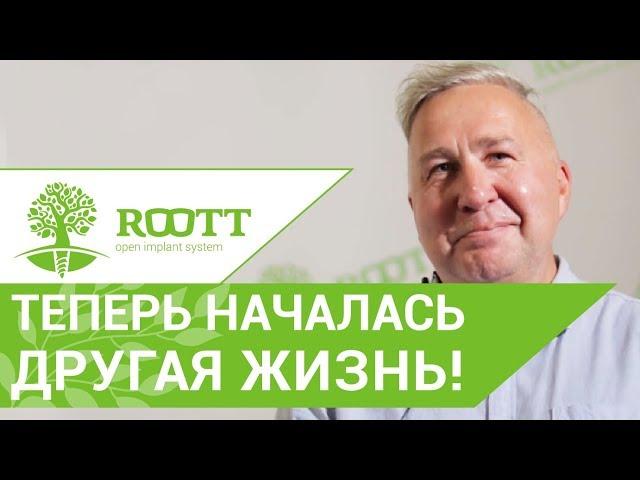   Базальная имплантация при полной адентии зубов. Видео отзыв пациента клиники ROOTT