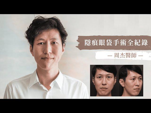 周杰醫師｜七合一隱痕眼袋手術完整全紀錄 視覺年齡瞬-5