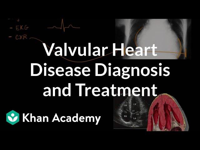 Valvular heart disease diagnosis and treatment | NCLEX-RN | Khan Academy