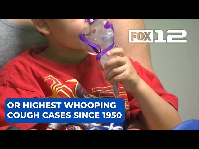 Oregon records highest whooping cough case count since 1950