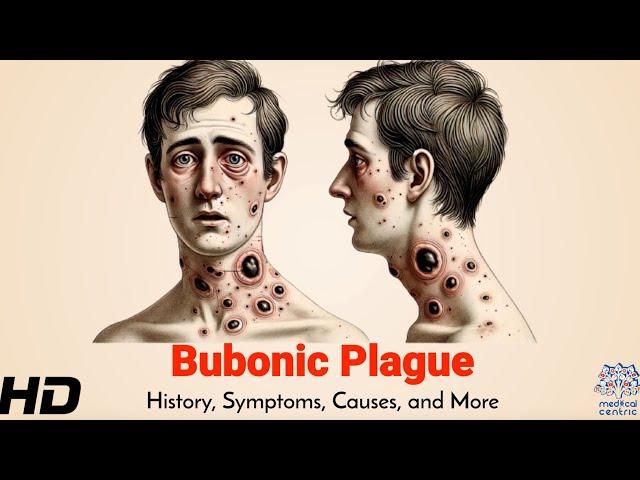 Bubonic Plague: The Black Death